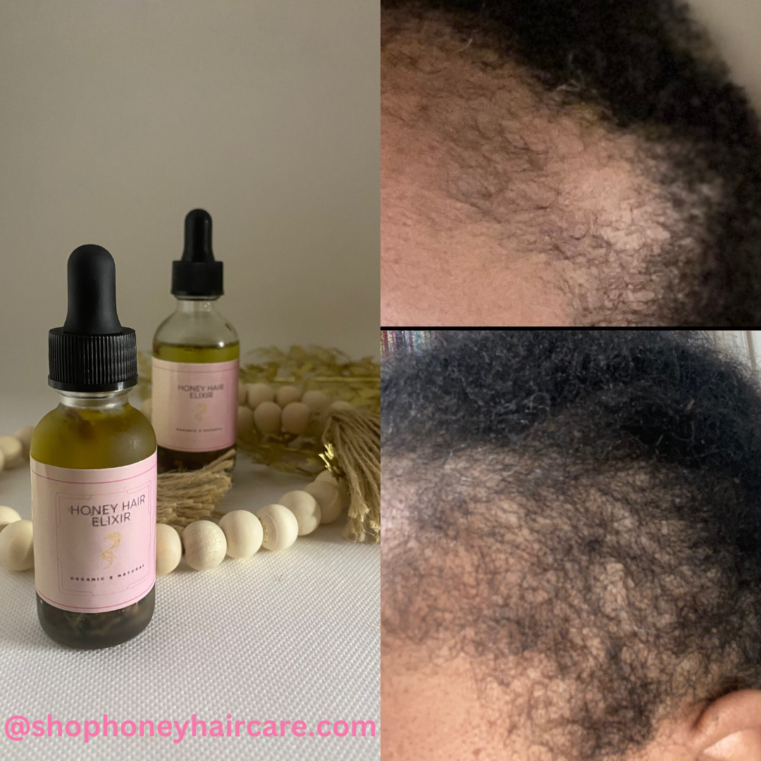 Hair growth oil